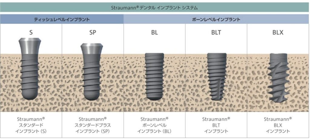 ストローマンインプラントの種類